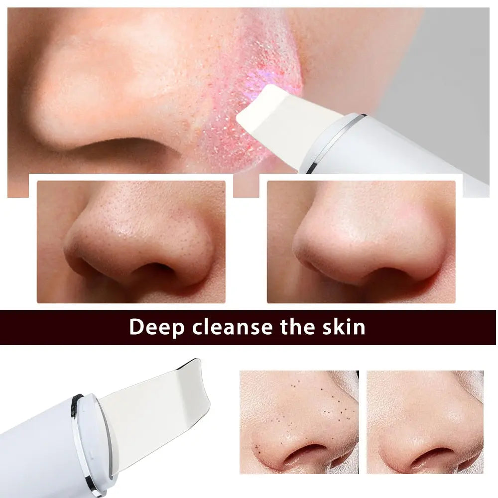 Ultrasonic Skin Scrubber Peeling Shovel EMS Microcurrent Ion Acne Blackhead Remover Face Deep Cleansing Facial Lifting Devices GlowingShell